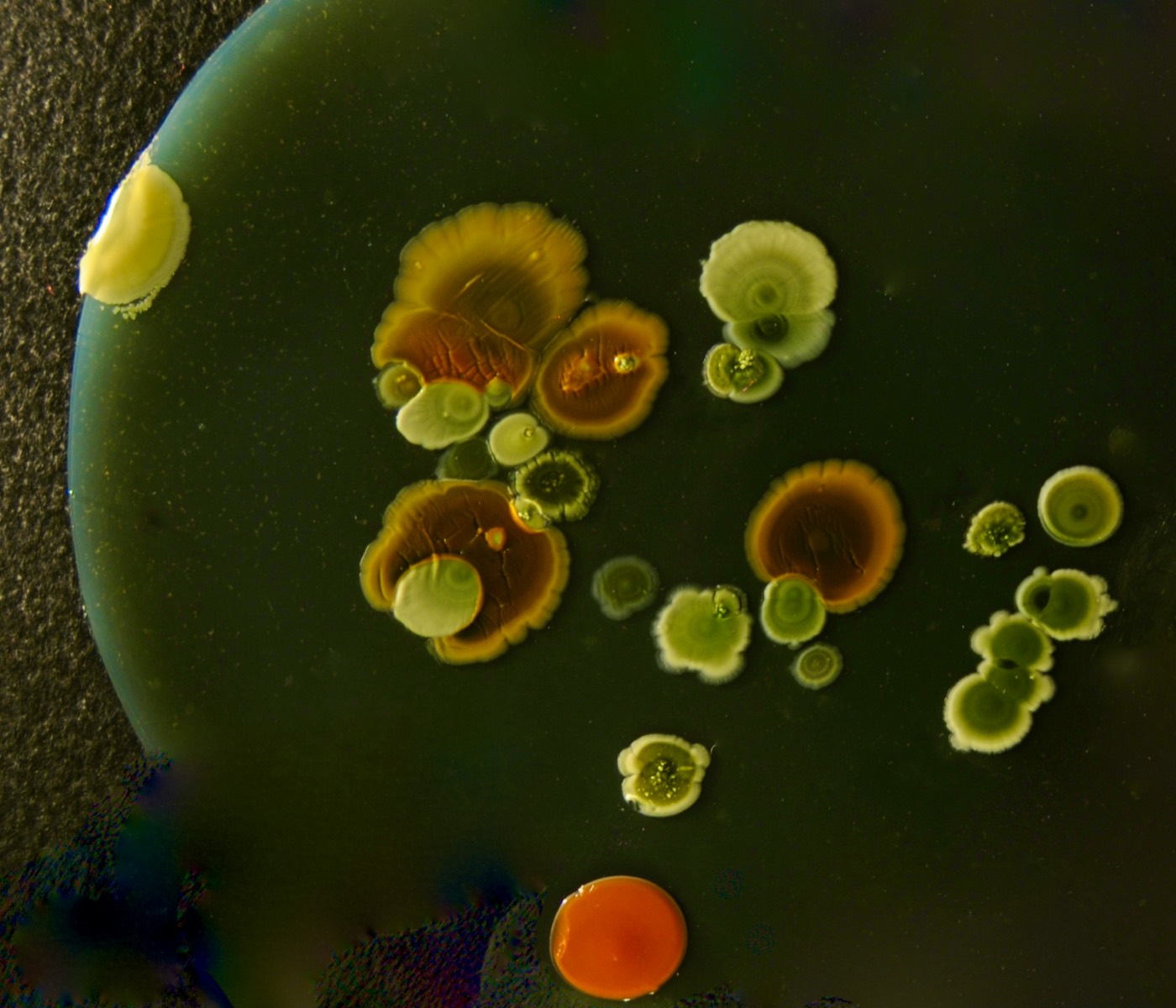 Microbial colonies grown on a culture media plate